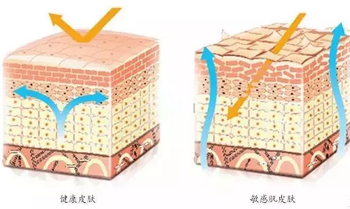 敏感肌膚與健康肌膚的對比，導(dǎo)致肌膚敏感的原因有哪些