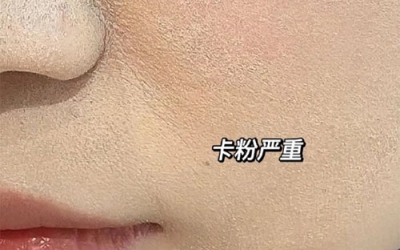 卡粉是什么意思？卡粉是什么原因引起的？